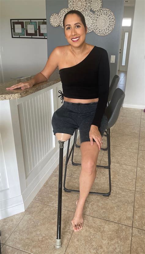 Amputee Only Fans Onlyfans Full Mega #918
