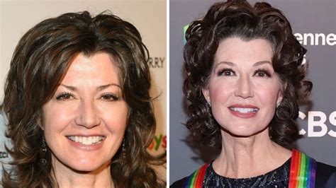 amy grant cosmetic surgery