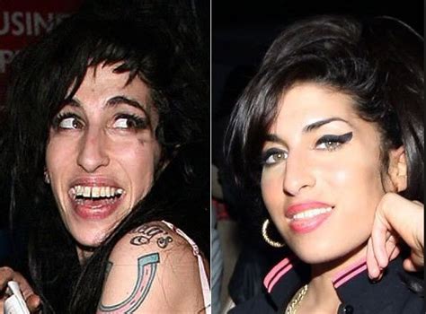 amy winehouse before after