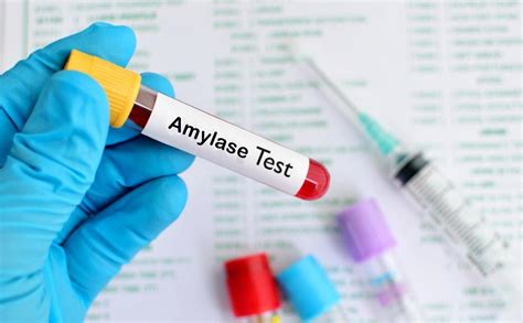 Amylase Test Labcorp