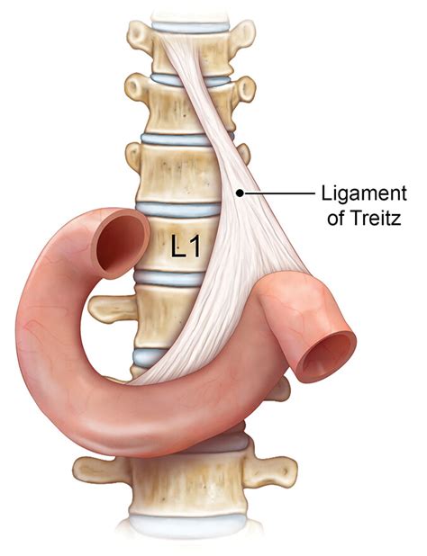 anatomic significance of ligament of treitz