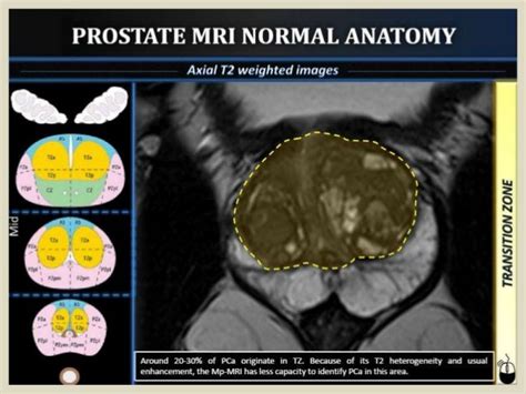 Anatomy Mri Prostate