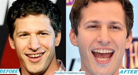 andy samberg age gap
