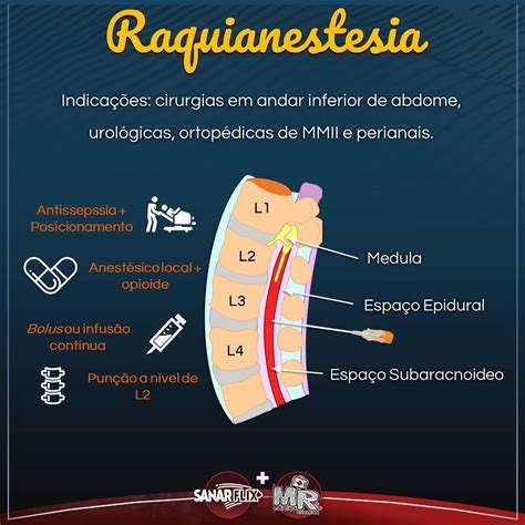 anestesia raquidiana