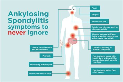 ankylosing spondylitis similar diseases