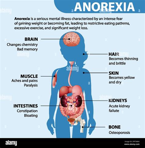 anorexia me