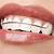 another word for dental retainer