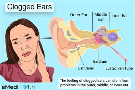 Another Word For Clogged Ears