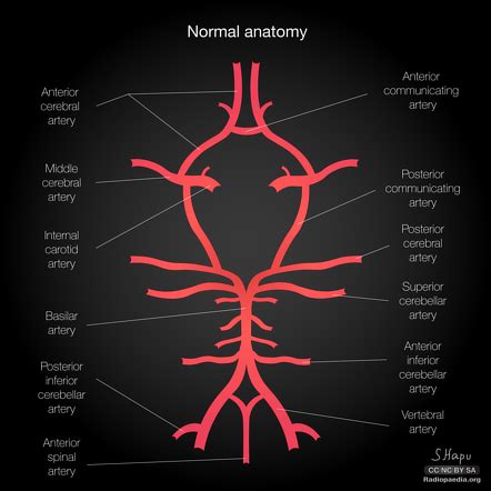 anterior cerebral artery radiopaedia