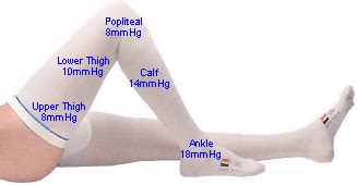 anti embolism stockings medical definition