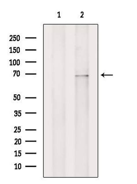 anti-zip4 antibody western blot