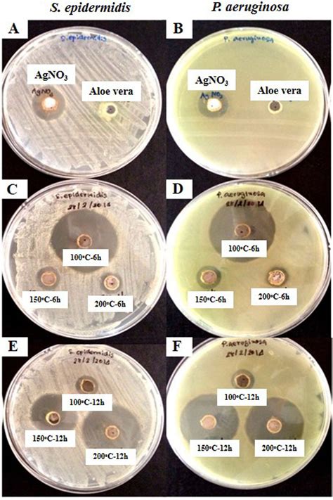 Antibacterial Activity Assay