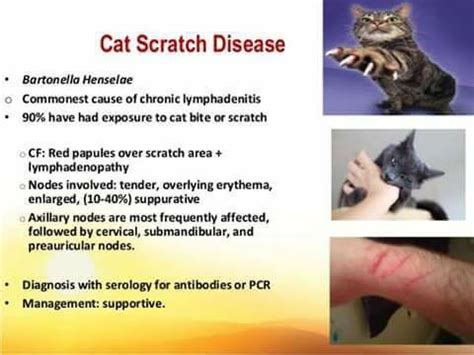 Antibiotic Cat Scratch