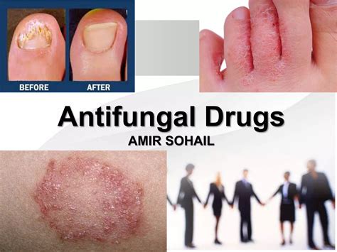 Antifungal Effect