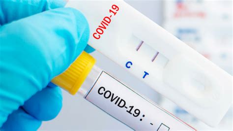 USC teams with L.A. city, county to explore rapid COVID19 antigen tests