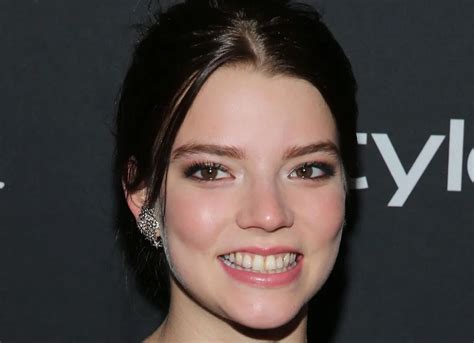 anya taylor-joy teeth accident