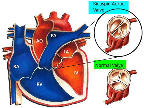 Understanding Aortic Valve Function and Replacement Options Today