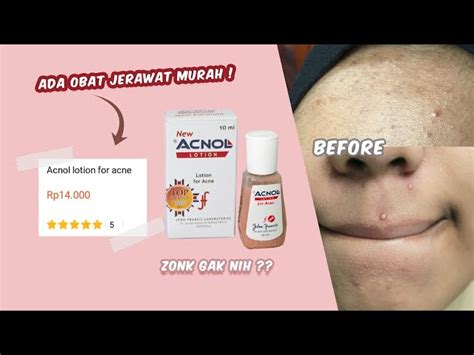 apa manfaat acnol