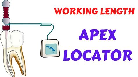 Apex Locators In Root Canal