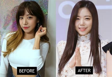 apink namjoo before and after