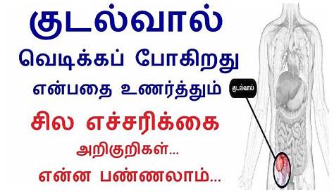 appendicitis symptoms in tamil TAMIL HEALTH