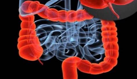 Laparoscopic Gallbladder Surgery Cost In Hyderabad