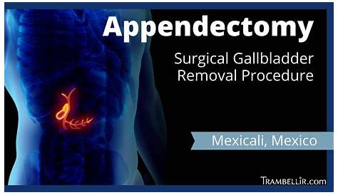 Appendectomy India Surgery Laparoscopic Appendectomy