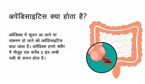 Appendix Operation Meaning In Hindi अपेंडिक्स की सूजन बिना ऑपरेशन के ठीक सकती है ? ..जाने कुछ
