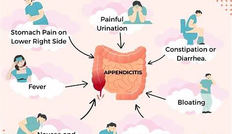Appendix Pain Symptoms Female Appendicitis Infographic. Stock Vector