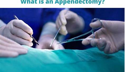 Appendix Surgery Cost In India Minimally vasive Appendicectomy dia At