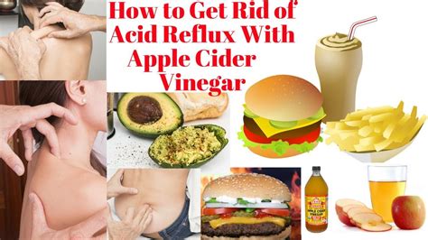 Apple Cider Vinegar for Acid Reflux Dr. Oz