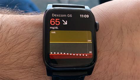 apple watch with diabetes monitor