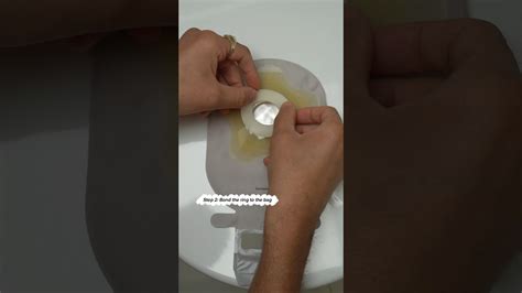 Application Of Colostomy Bag