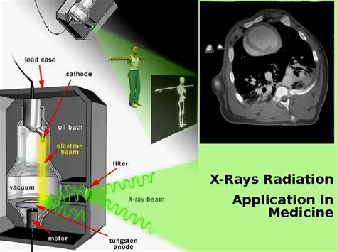 Application Of X Rays In Engineering