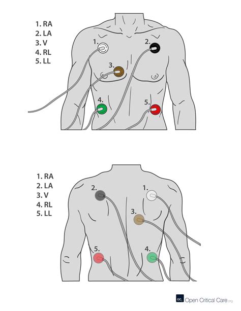 Applying Electrodes For Ecg