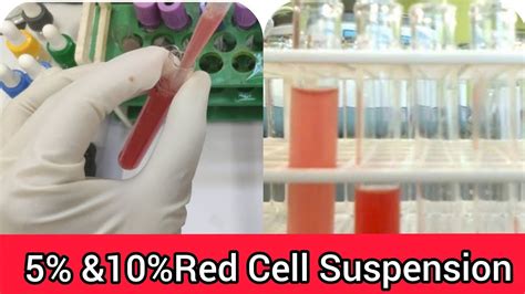 approximate red cell suspension