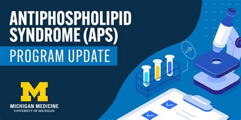 APS Michigan: Unlocking Efficiency Secrets