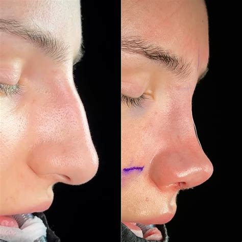 Arched Nose Makeup Techniques That Will Transform Your Look