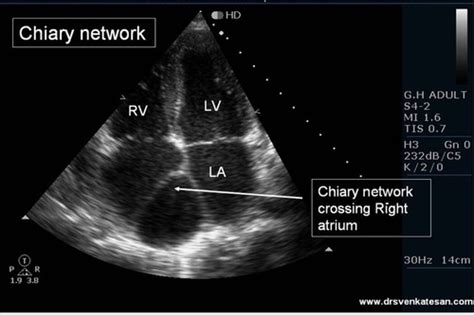 ardms adult echo outline