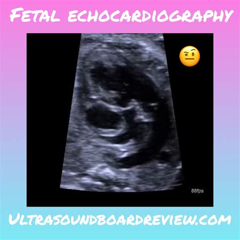 ardms fetal echo requirements