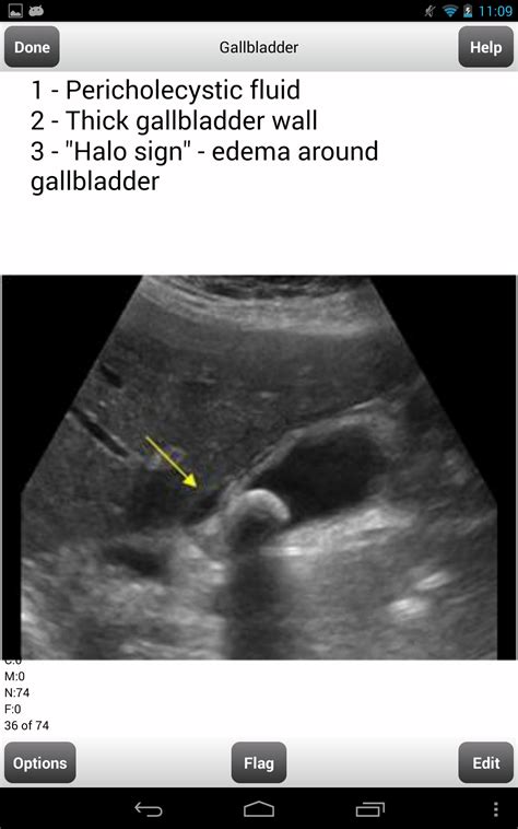 ardms ultrasound abdominal exam