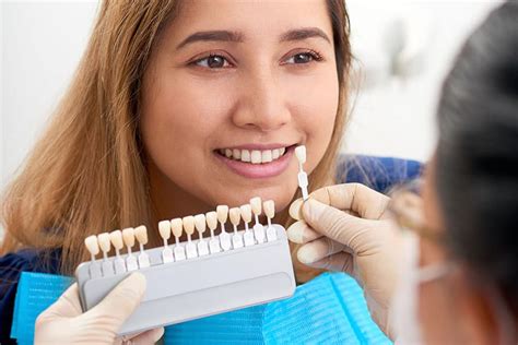 Are Veneers Covered By Health Insurance MCHWO