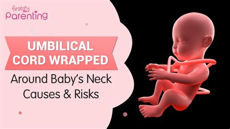are babies necks fragile