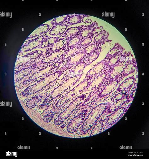 Are Bacteria Visible Under A Light Microscope