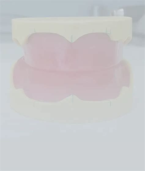 Are Bite Blocks Removable