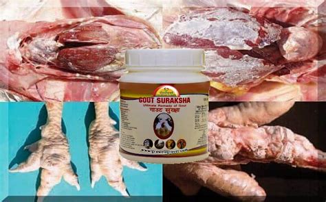are chicken livers bad for gout