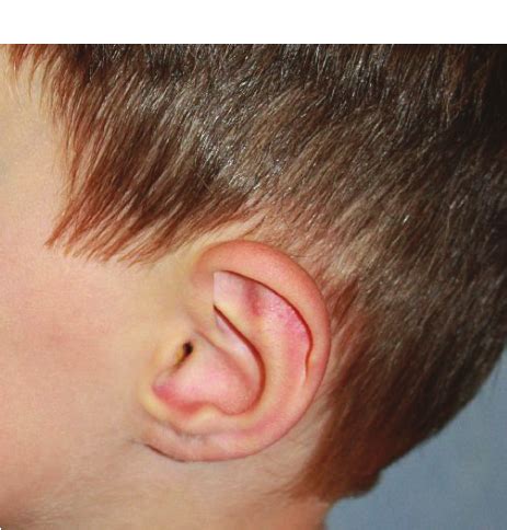 Are Ears Very Vascular
