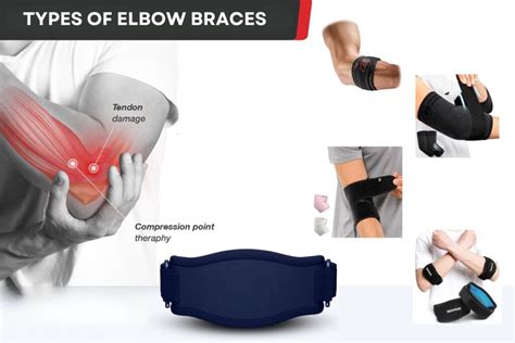 Are Elbow Braces Effective