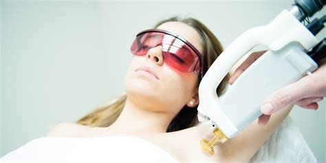 are laser hair removal safe