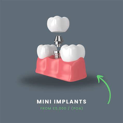 Are Mini Dental Implants Expensive? A Comprehensive Cost & Value Guide